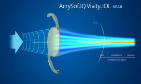 Nuevas lentes para presbicia: Las lentes intraoculares de visión extendida 5 Las mejores lentes para presbicia que no generan halos ni deslumbramientos
